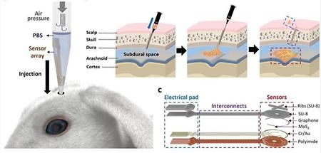 Professor Jong-Hyun Ahn's research team at Yonsei University develops an injectable brain nerve sensor to replace cranio